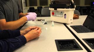 How to Run a Malaria Rapid Diagnostic Test [upl. by Arba]