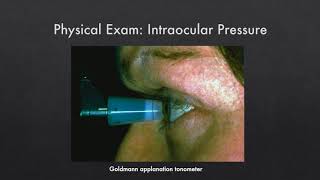 Understanding Acute Angle Closure Glaucoma [upl. by Olney]