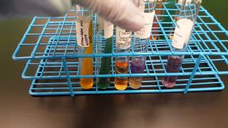 Microbiology Escherichia coli Biochemical testing interpretation [upl. by Hagar]