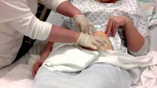 Colostomy Care Teaching Video [upl. by Ttegirb]