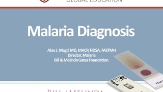 Malaria Diagnosis by Alan Magill Gates Foundation [upl. by Fellner]