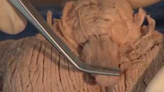 Cranial Nerves Neuroanatomy Video Lab  Brain Dissections [upl. by Warram]