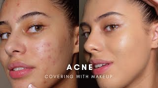 HOW TO COVER ACNE WITH MAKEUP BASE ROUTINE [upl. by Sunday]