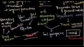 Clostridium perfringens infection and pathogenesis [upl. by Quartet815]