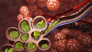 Pneumonia  Discharge Instructions  Nucleus Health [upl. by Adnohs]