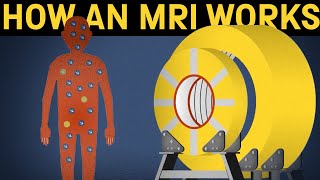 How does an MRI machine work [upl. by Meuse929]