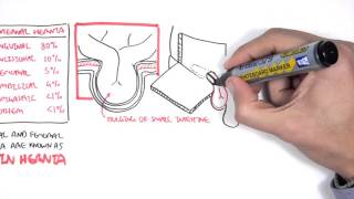 Anatomy of the inguinal region simplified [upl. by Ecinwahs]