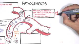 Malaria Pathophysiology [upl. by Epolulot]