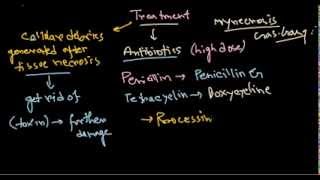 Clostridium perfringens treatment [upl. by Able]