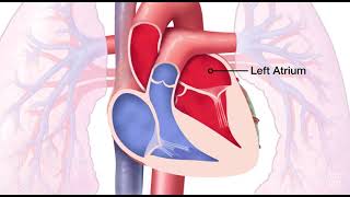 Mitral Valve Analysis TomTec [upl. by Ssor]