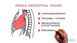 Mediastinal anatomy and nodal stations on CT [upl. by Schlessinger404]