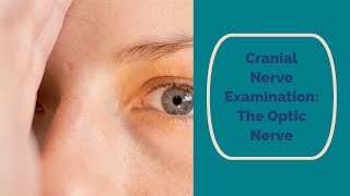 Cranial Nerve Examination CN 2 Optic nerve [upl. by Anovad]