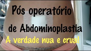 Pós operatório de Abdominoplastia lipoaspiração e enxerto de glúteo  dicas [upl. by Ieso]