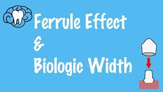 Ferrule Effect and Biologic Width [upl. by Jos612]