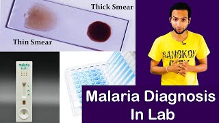 How To Diagnosis Malaria At Laboratory [upl. by Moffit194]